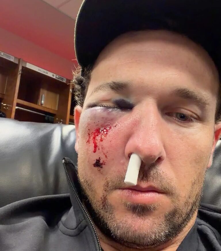 Aún no hay un diagnóstico del estado de salud de Alex Bregman